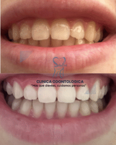 Post Instagram Fotos Momentos Collage Simple Blanco